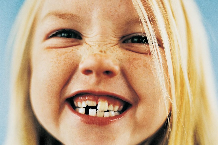 Denti da latte7