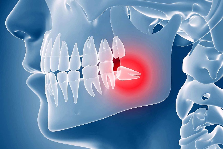 Denti del giudizio3