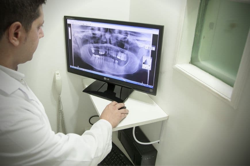 Le radiografie dentali, quali sono e quanto sono sicure?