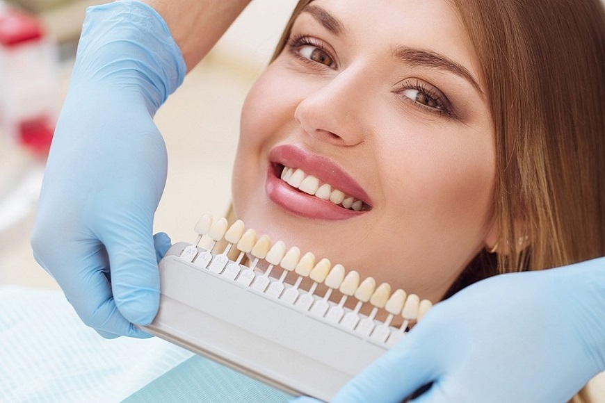 COSTO E DURATA DELLA CAPSULA DENTALE