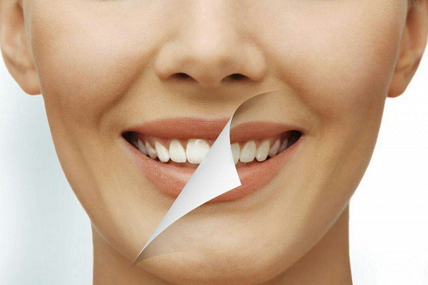 ODONTOIATRIA ESTETICA E COSMETICA, DIFFERENZE E CARATTERISTICHE